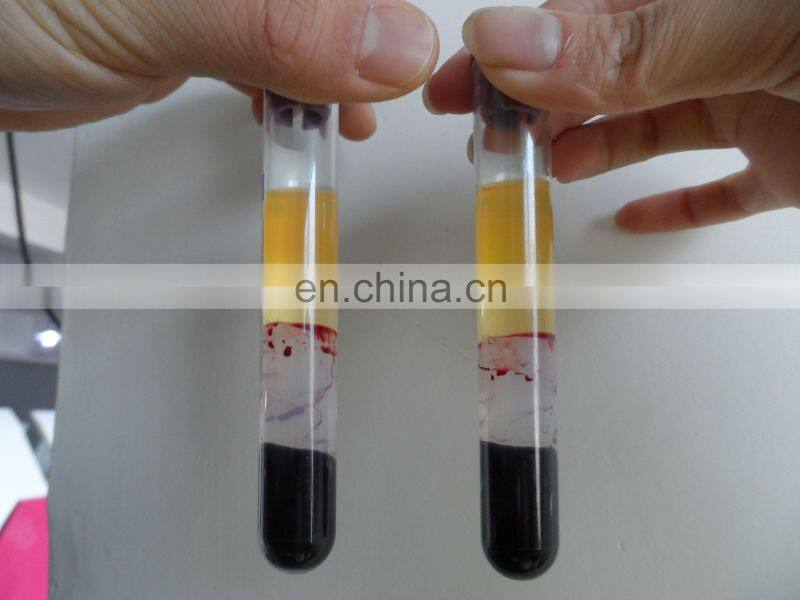 TD4-PRP Economic PRP Centrifuge