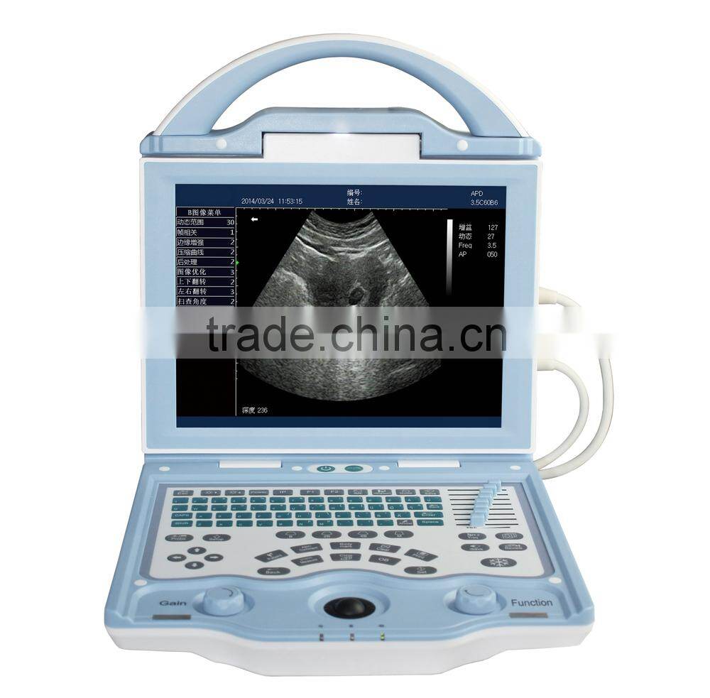 Model:FN560V Pregnancy sheep ultrasound scanner