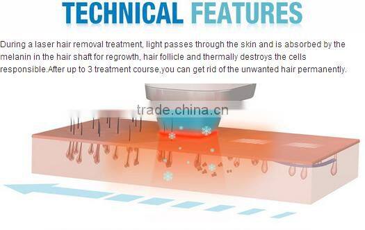 Sapphire laser diode 808nm machine painless for permanent hair removal