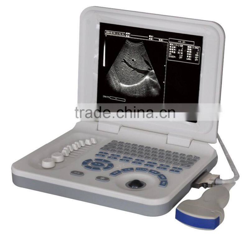 vet ultrasound with10.8" LED display 3D cheap professional animals use portable ultrasound 3018VL