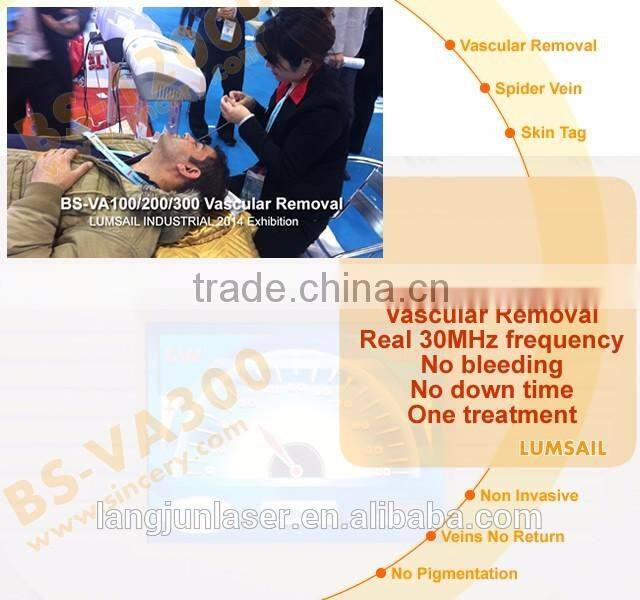 Beautiful Professional Cure Telangiectasia Treatment Vein Removal Equipment