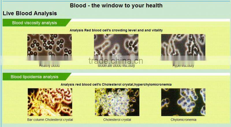 Hot New Retail Products Daily Healthcare Low Level Laser Medical Apparatus