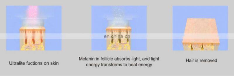 GSD Star product!!! Ipl and professional hair removal beauty machine with CE