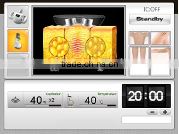 HOTTEST kim 8 new cavitation rf vacuum slimming machine