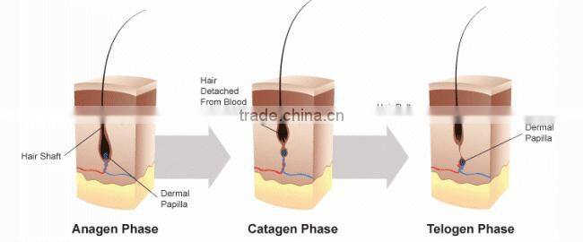 Portable Hair Loss Treatment Hair Regrowth Comb For Male Pattern Baldness