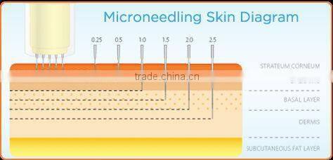 micro needles device dermapen cost