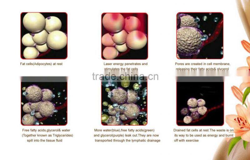 Lipo laser fat removal ultrasonic liposuction cavitation slimming BR8.6