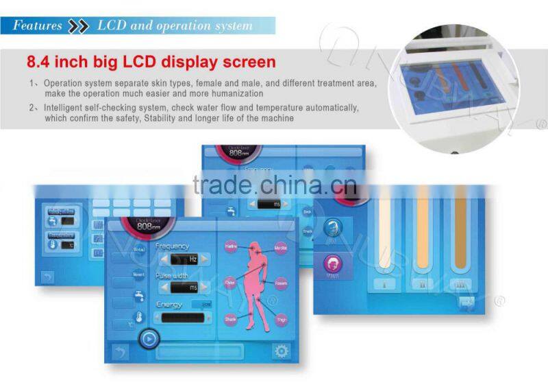 solon equipment 808nm wavelength permanent hair removal best women hair removal machine