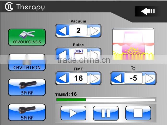 RF fat freezing machine home device Cryo handles working cold lipolysis weight loss machine