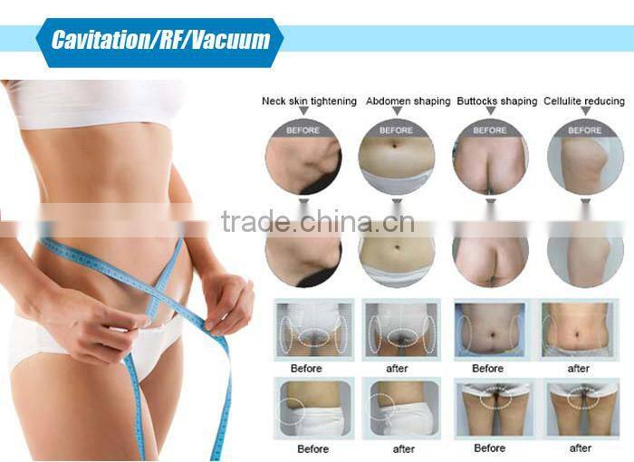 Hot 5 treatment handles Cavitation RF Fat lost machine for beauty salon use