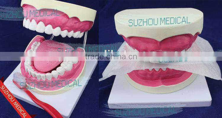 Teeth care model