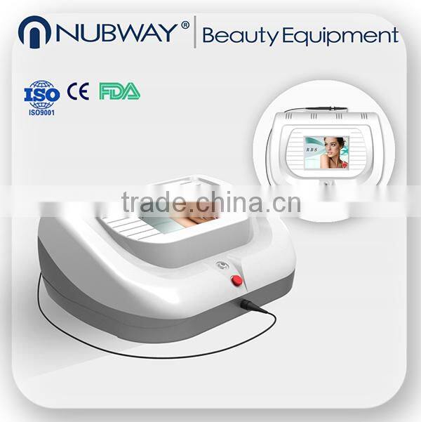 Lastest obvious effective! Professional 30Mhz ipl spider veins removal / laser blood vessels removal machine