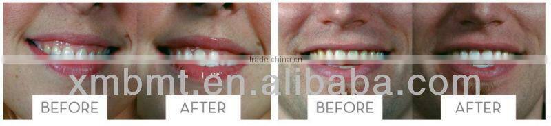 6% Hydrogen Peroxide Teeth Whitening Strips