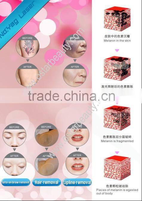 (OstarBeauty) laser tattoo removal nd yag ipl hair removal machine