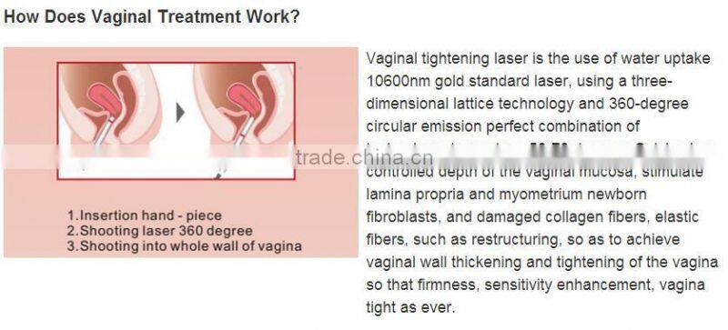 Hot Sale Co2 Cartridge 16g with High Quality