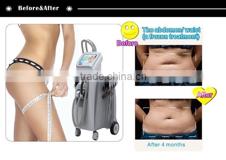 Cryolipolysis Cold Lipo Laser combined for body fat removal machine