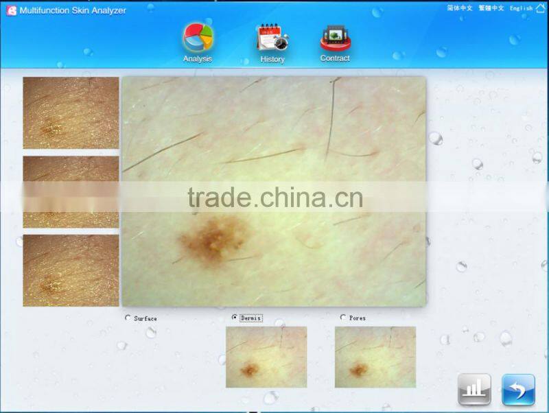 AYJ-J016 hot offer skin care 3d skin analyzer beauty deveice