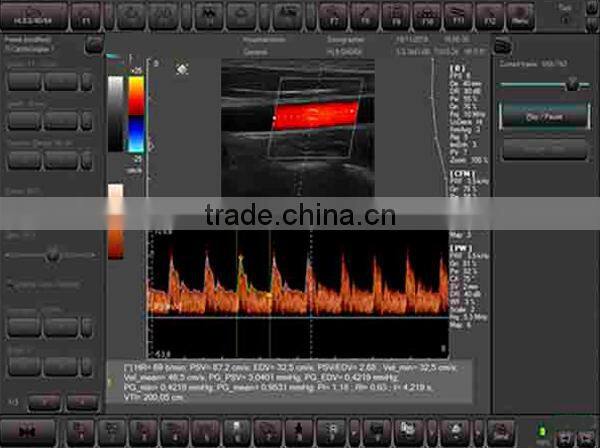 Coupon available! Ipad ultrasound scanner, touch screen scanner 3D color doppler MSLCU22-N