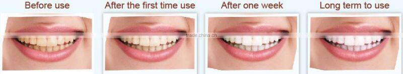 New Product 2014, Magic Teeth Whitening Kit, Alibaba Express