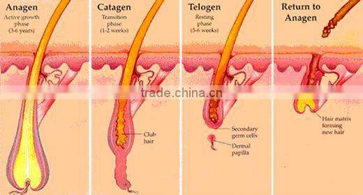 2016 e light hair removal wrinkles removal epilator lady facial device