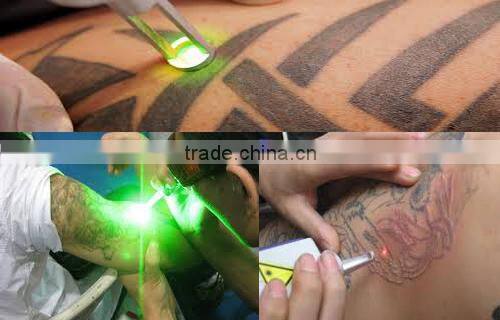 Hot selling ! Q Switch ND YAG Laser Eyeline Removal