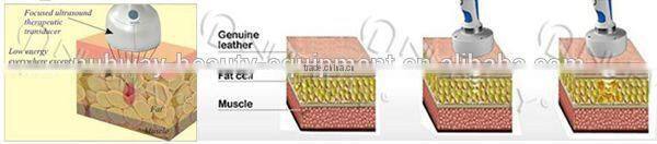 Newest body shaping machine HIFUSHAPE no side effect ultrasonic slimming machine