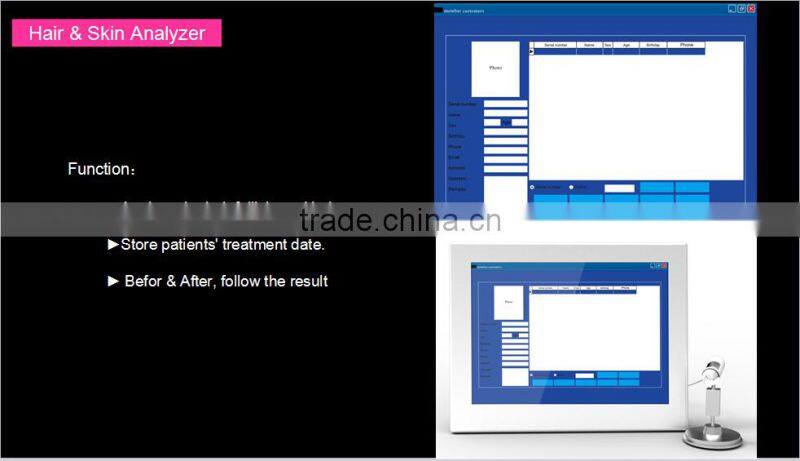 Hair Growth Diode Laser / hair growth laser/ Diode Laser Hair Growth / Hair Loss Treatment