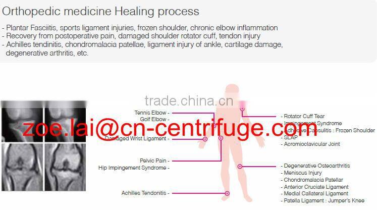 PRP Centrifuge PRP Kit Pro PRP