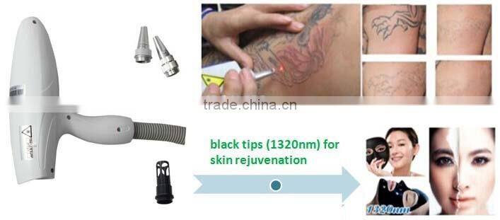 Best 1064nm 532nm 1320nm pulse q switch birthmark removal laser