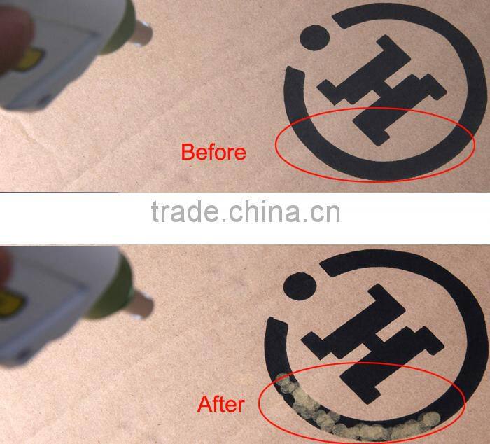 Professional 3in1 Q switch nd yag laser bipolar rf laser hair and tattoo removal