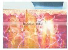 Professional Multifunction IPL SHR Hair Removal Laser beauty machine with Elight made in China