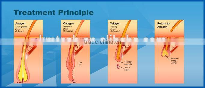 Hot sale ipl photofacial machine for home use