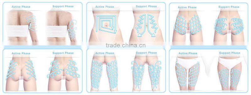 Joint Treatment ESWT for Cellulite With ESWT or RSWT White Color portable