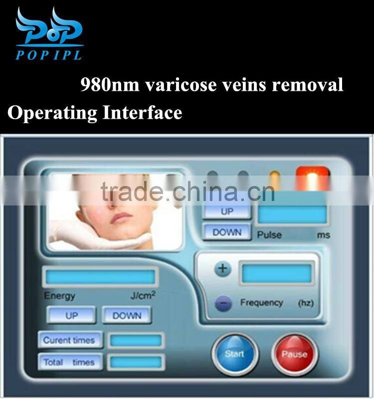 laser Spider vein removal 15W high power / Vascular removal / Blood vessel removal