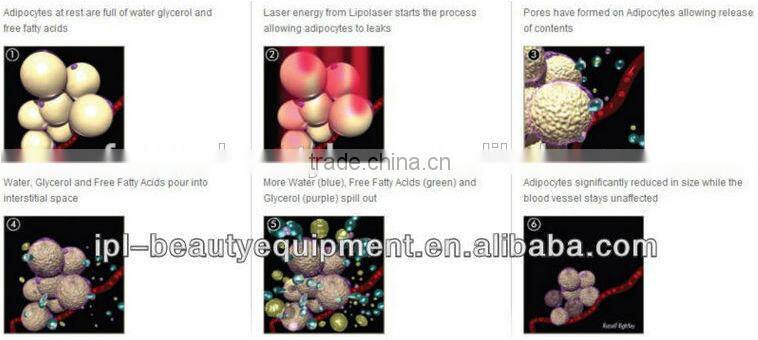 Japan imported lamp CE approved lipo laser for fat burning lipo laser for fat burning