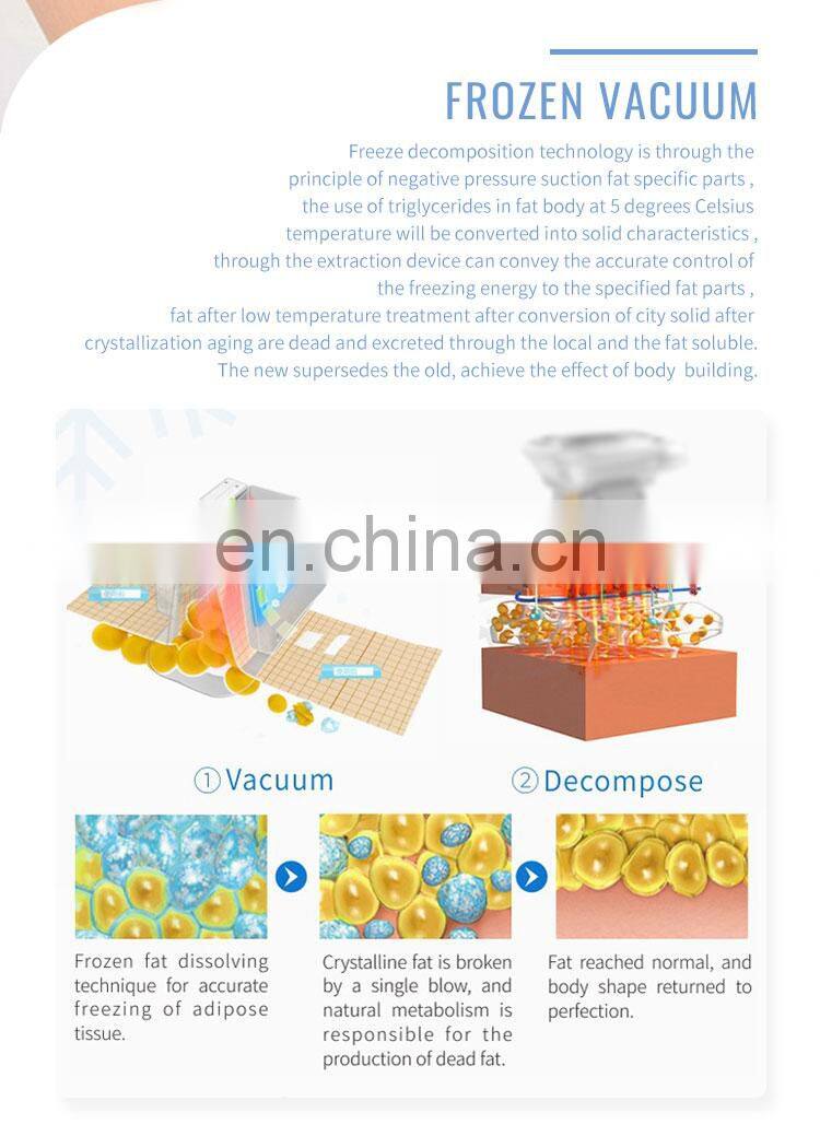 Multifunction Cryo Cavitation Rf 6 Handles weight loss Cool Body shaping Fat Freezing Slimming Machine for double chin removal