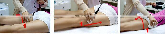 Professional and popular ultrasound machine for pregnancy