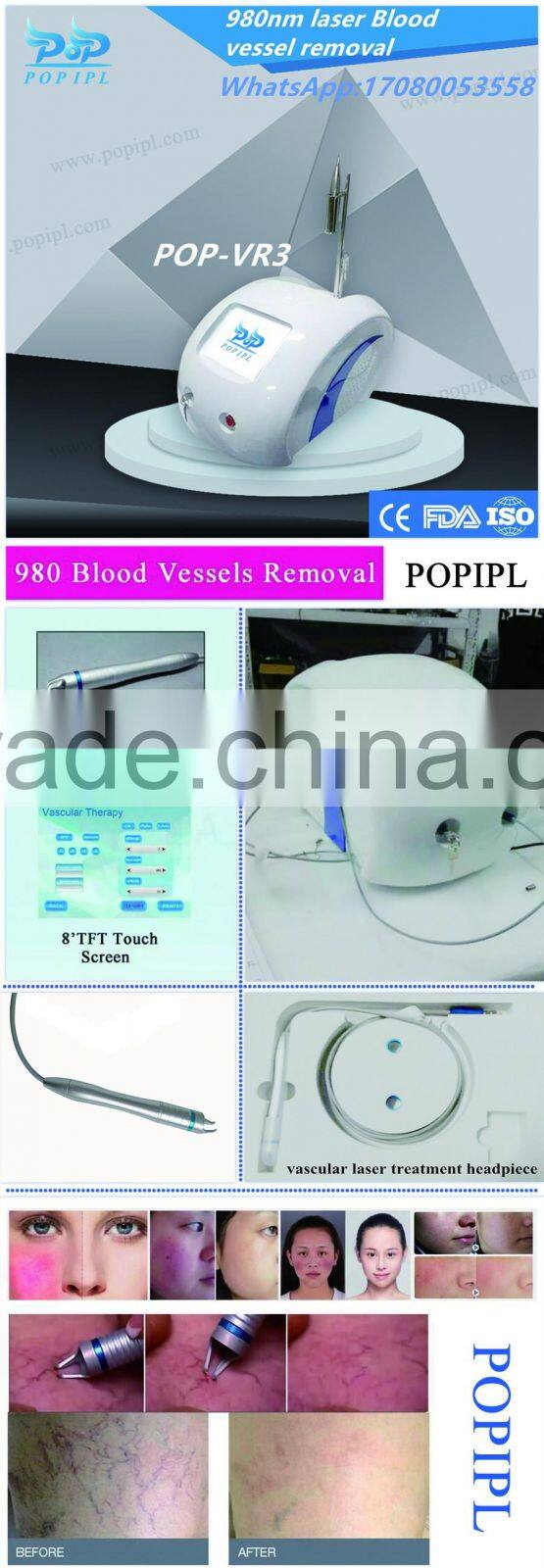 Spider vein removal 980nm laser / Vascular removal /Blood vessel removal 980nm VR3 980nm medical diode laser