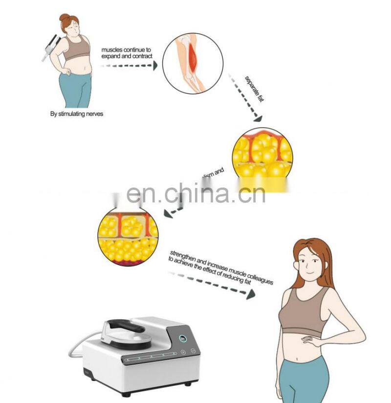 Ems Body Slimming Machine Body Shaping High Intensity Electromagnetic Muscle Oem/Odm 4 Channels Ems Tens Unit Massage Machine