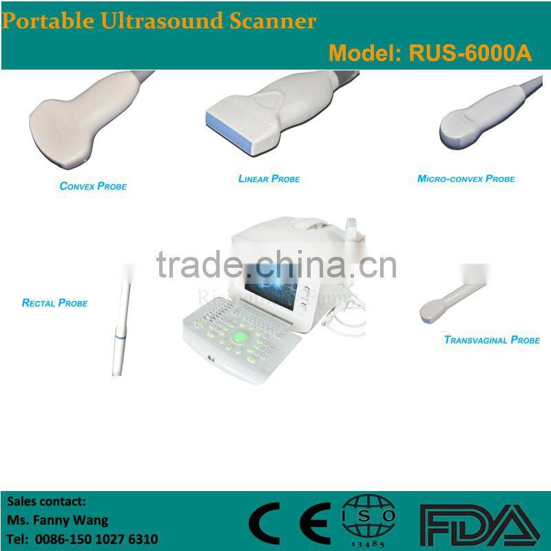 Factory price!!CE approved 3.5Mhz multi-frequency convex probe Portable B-Mode Ultrasound Scanner system