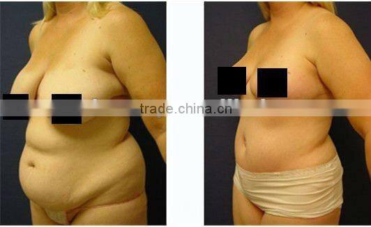 Multimedia visible image display system slimming machine for salon&home use(FB-F017)