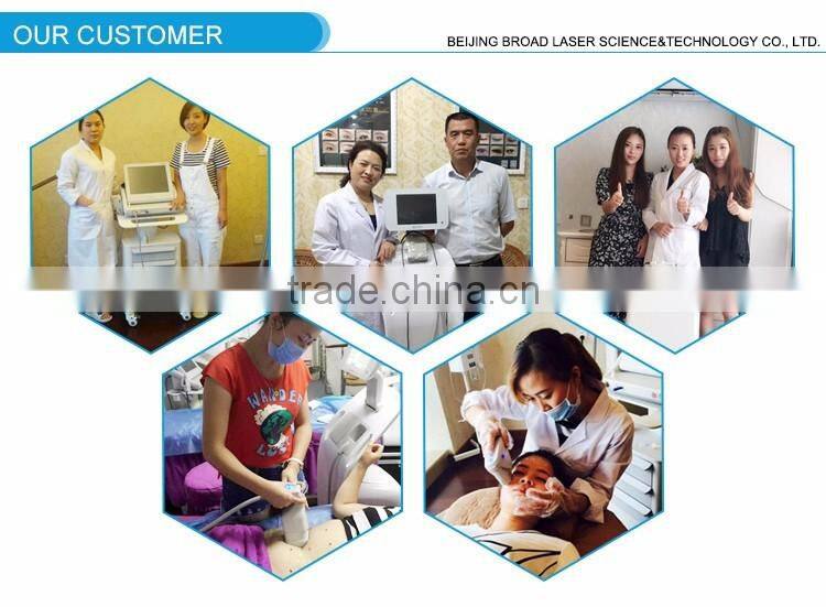 Big promotion depilation machine portable shr great service