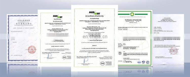 GSD 810nm diode laser permanent hair removal