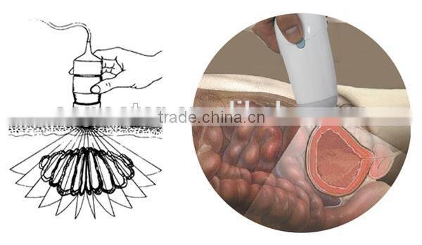CareScan-1 Bladder Scanner Diagonosis Portable Scanner