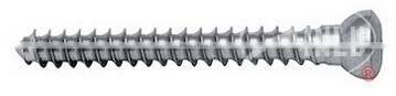 Proximal femur condylus plates orthopedic implant