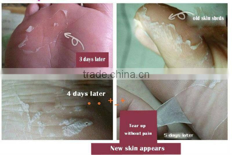 Magic moisturizing and whitening baby foot peeling mask