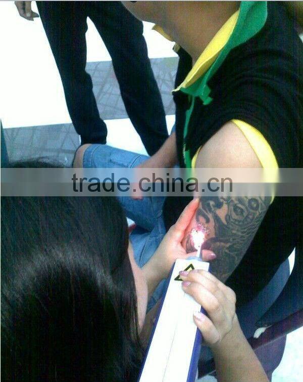 nd yag laser q switch/nd yag laser beauty machine/nd yag laser