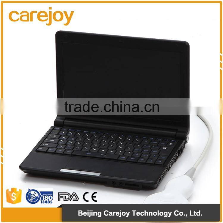 portable ultrasound scanner ultrasound machine with low price