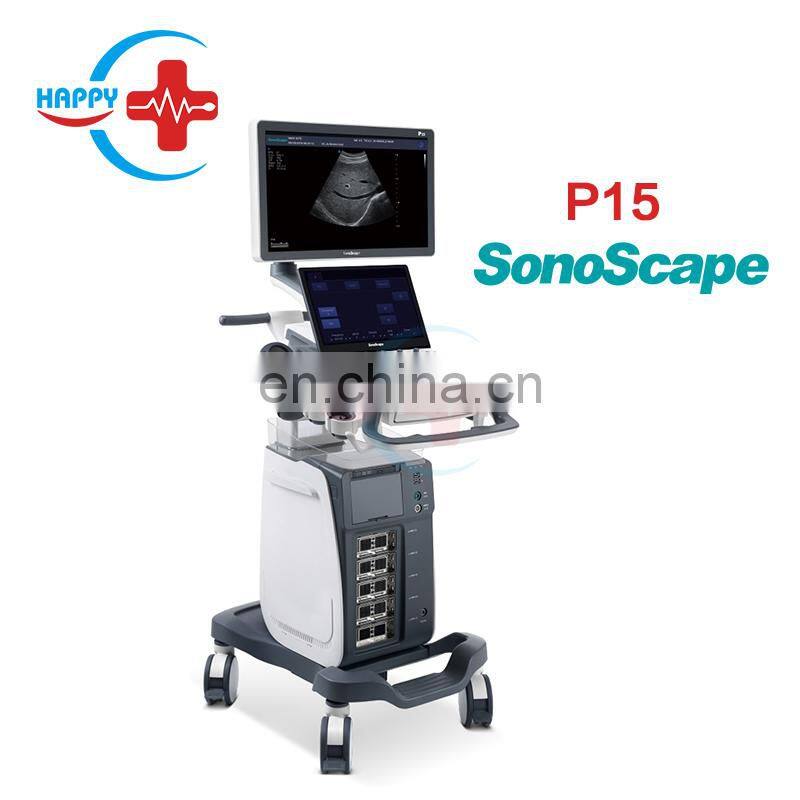 Latest Version Sonoscape P15 Trolley Color Ultrasound machine /cw color doppler ultrasound Sonoscape P15