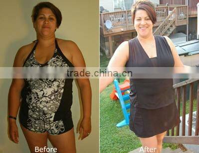 2016 long lasting effects ultrasonic liposuction slimming machine